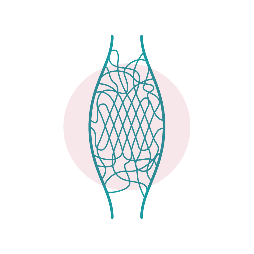 Faszienbehandlung am Oberschenkel durch ISBT-Bowentherapie